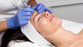 crystal microdermabrasion